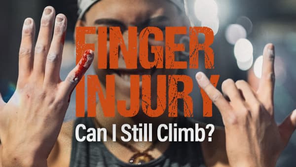 Finger Injury Can I Still Climb