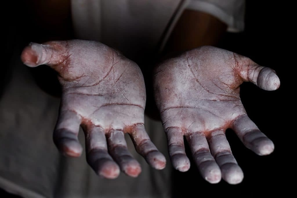 Hands with Climbing Chalk